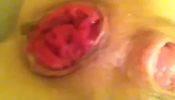 anal