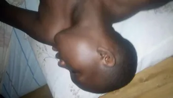 Digging deep into the black teen