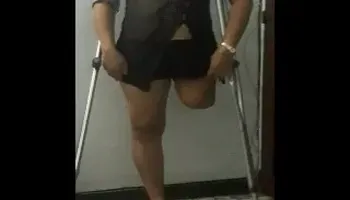 amputated stump massage